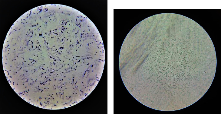 Production of Single-Cell Oil from a Local Isolate <i>Bacillus subtilis</i> Using Palm Fronds.