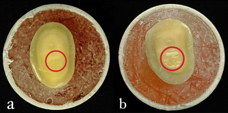 The Role of Duration of Chlorhexidine Gluconate 2% Application on the Shear Bond Strength of a Total Etch Bonding Agent: A Comparative Study.