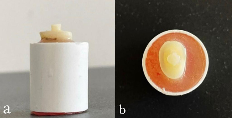 The Role of Duration of Chlorhexidine Gluconate 2% Application on the Shear Bond Strength of a Total Etch Bonding Agent: A Comparative Study.