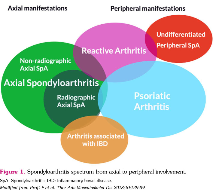 Beyond the horizon: Innovations and future directions in axial-spondyloarthritis.