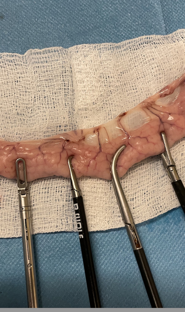 How Safe Are the Laparoscopic and Robotic Graspers? Evaluation of the Novel Avatera Robotic Surgical System: An Acute In Vivo Study on a Porcine Model.