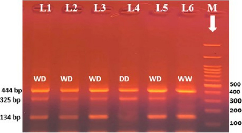 Detection of EGFR gene polymorphisms in non-small cell lung cancer Egyptian patients: a case-control study.