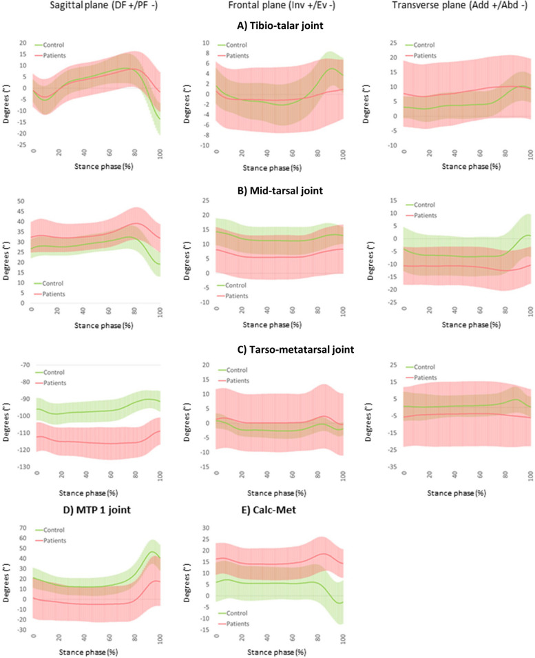 Foot biomechanics in patients with advanced subtalar- and mid-tarsal joint osteoarthritis and poorly responding to conservative treatment.