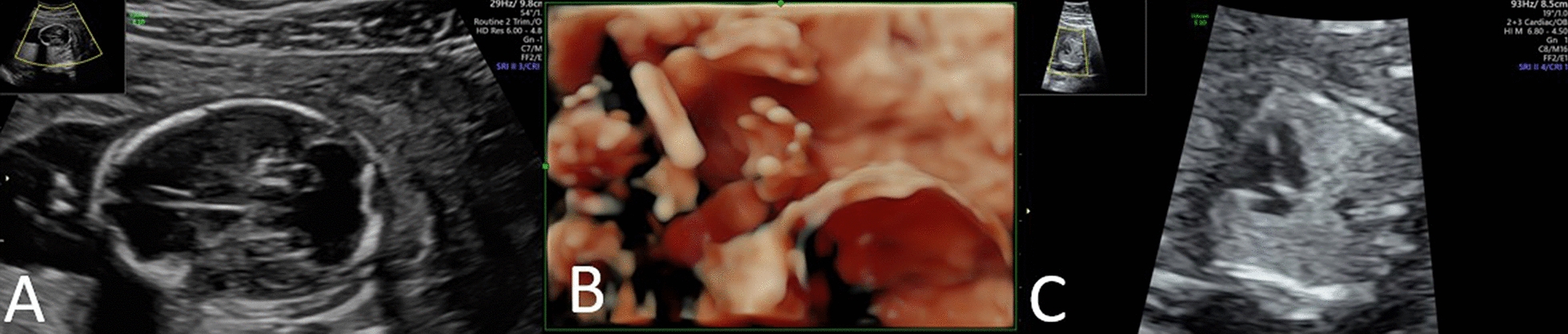 Abstract Image
