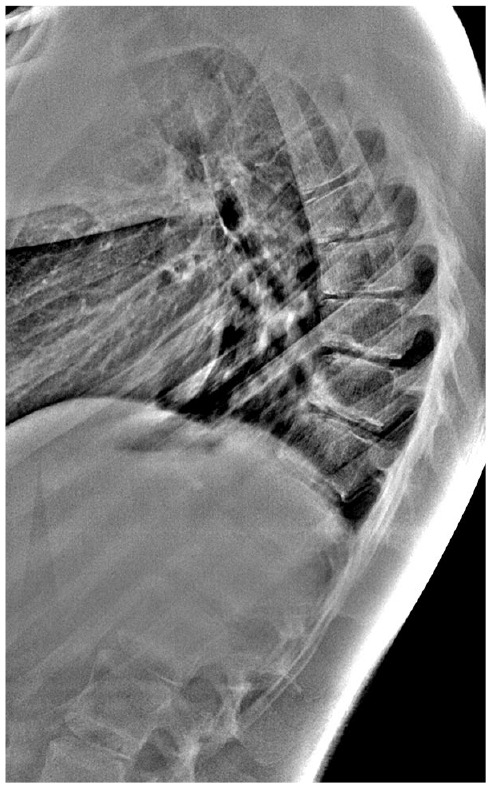 Clinical examination and imaging resources in children and adolescent back pain.