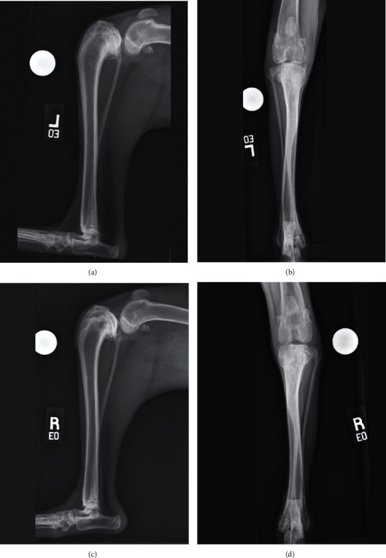 Use of Preoperative 3D Virtual Planning and 3D-Printed Patient-Specific Guides to Facilitate a Single-Stage Cranial Closing Wedge Ostectomy and Tibial Plateau Leveling Osteotomy Procedure to Address Proximal Tibial Deformity, an Excessive Tibial Plateau Angle, and Cranial Cruciate Ligament Insufficiency in a Dog.