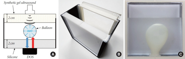 Hybrid Bladder Phantom to Validate Next-Generation Optical Wearables for Neurogenic Bladder Volume Monitoring.