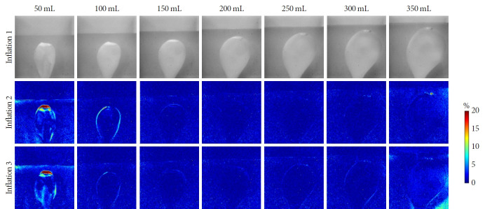 Hybrid Bladder Phantom to Validate Next-Generation Optical Wearables for Neurogenic Bladder Volume Monitoring.