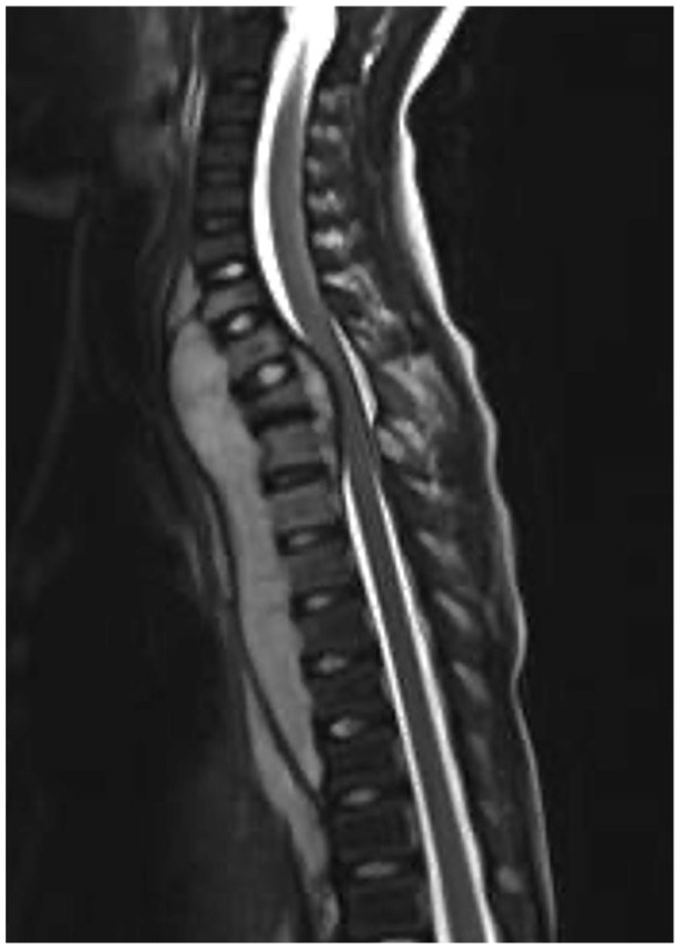Clinical examination and imaging resources in children and adolescent back pain.