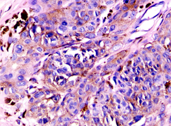 What's new in dermatopathology 2023: WHO 5th edition updates.