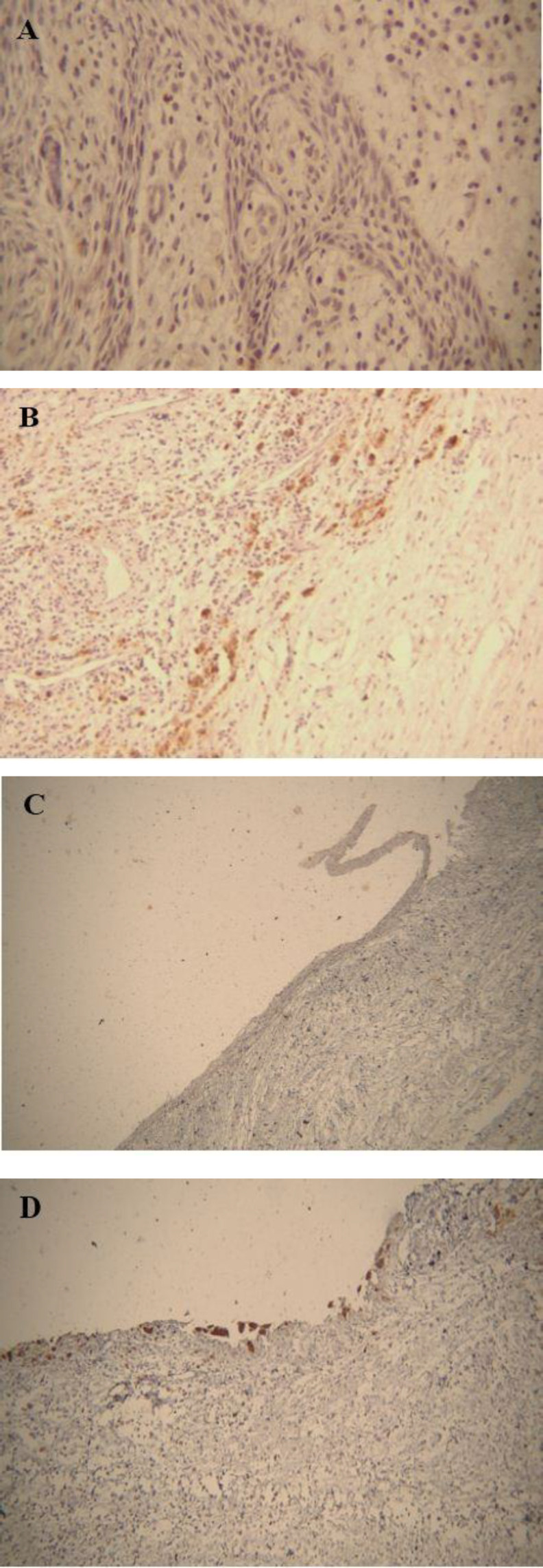A Comparative Immunohistochemical Expression of TRAP in Odontogenic Cysts.