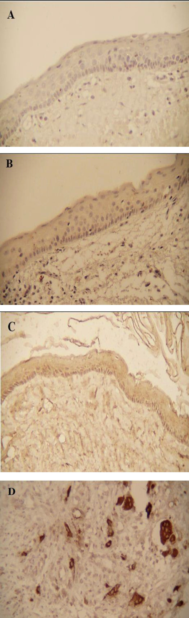 A Comparative Immunohistochemical Expression of TRAP in Odontogenic Cysts.