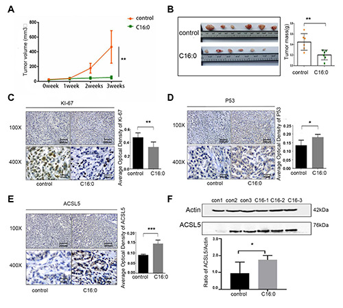 Regulatory roles of ACSL5 in the anti-tumor function of palmitic acid (C16:0) <em>via</em> the ERK signaling pathway.