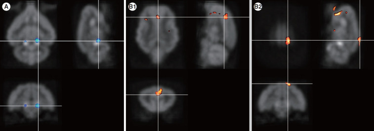 Increased Resting-State Positron Emission Tomography Activity After Cochlear Implantation in Adult Deafened Cats.