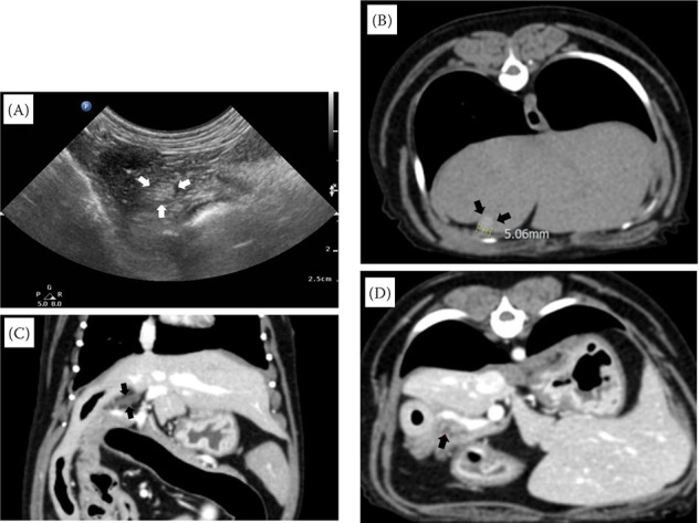 Gallbladder atrophy associated with pancreatitis: Clinical and advanced imaging diagnosis in a dog.