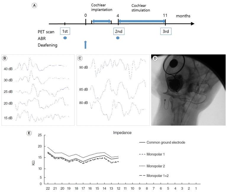 Increased Resting-State Positron Emission Tomography Activity After Cochlear Implantation in Adult Deafened Cats.