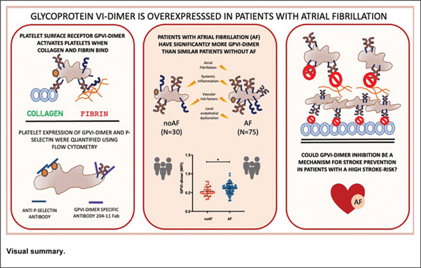 Platelet Receptor Glycoprotein VI-Dimer Is Overexpressed in Patients with Atrial Fibrillation at High Risk of Ischemic Stroke.