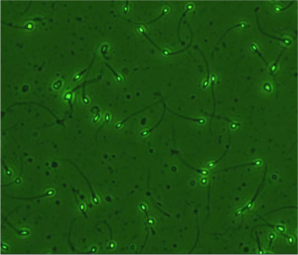 External quality assessment scheme for sperm DNA fragmentation: a pilot study in China.