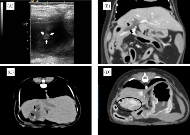 Gallbladder atrophy associated with pancreatitis: Clinical and advanced imaging diagnosis in a dog.