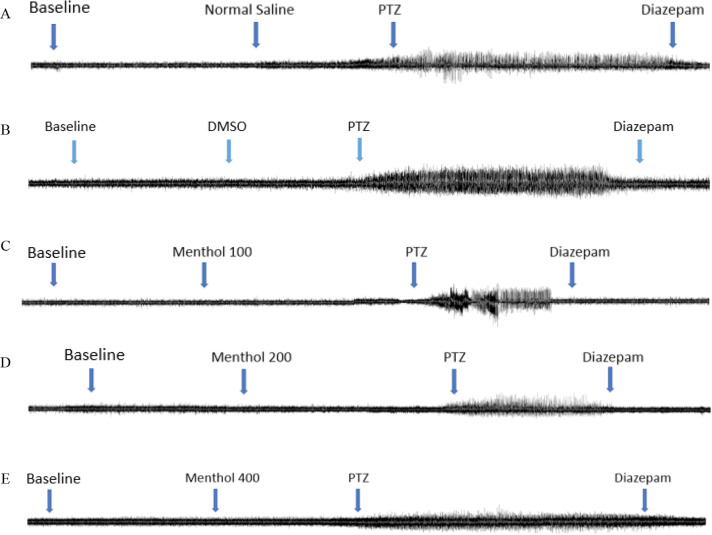 Menthol Dissolved in Dimethyl Sulfoxide Protects Against Epileptiform Activity Induced by Pentylenetetrazol in Male Rats.