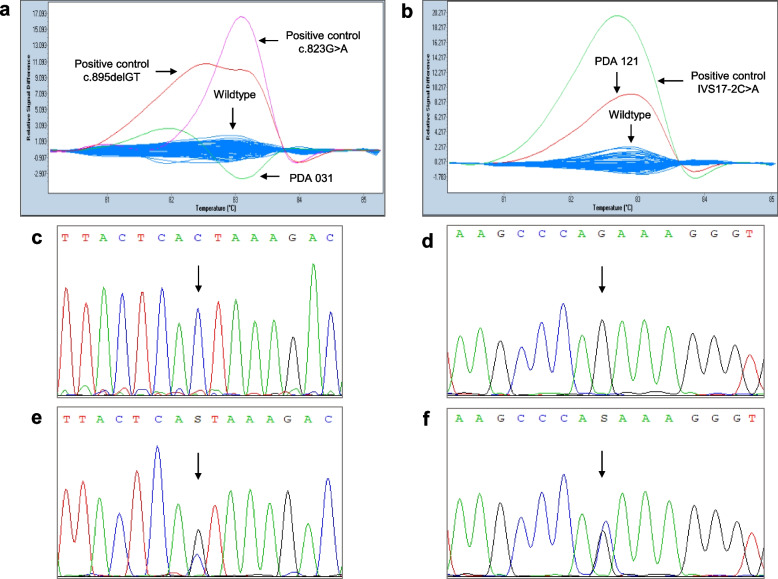 Prevalence of BRCA1 and BRCA2 germline variants in an unselected pancreatic cancer patient cohort in Pakistan.