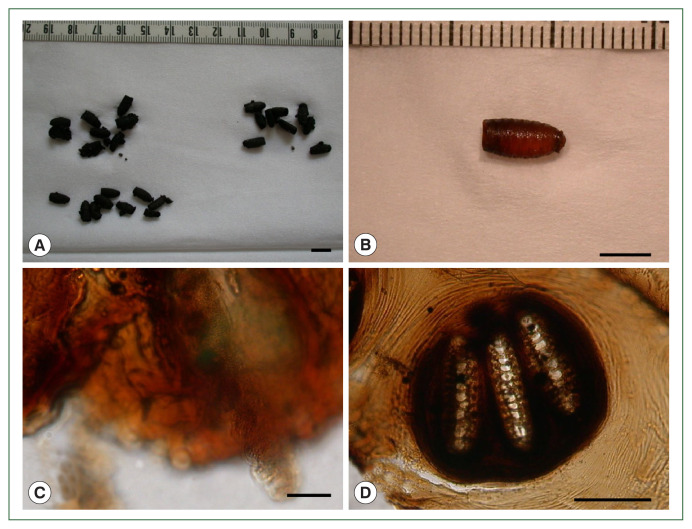 Morphological studies of fly puparia (Diptera: Calliphoridae) in the soil from a Joseon Dynasty grave in Korea.