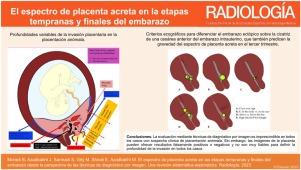 El espectro de placenta acreta en la etapa temprana y final del embarazo. Un repaso a través de la imagen