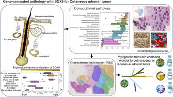 Strategic Approach to Heterogeneity Analysis of Cutaneous Adnexal Carcinomas Using Computational Pathology and Genomics