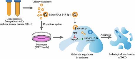 Urinary exosomes from patients with diabetic kidney disease induced podocyte apoptosis via microRNA-145-5p/Srgap2 and the RhoA/ROCK pathway