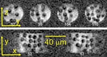 Micron-scale magnetic resonance imaging based on low temperatures and dynamic nuclear polarization