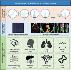 Dual-energy CT: A new frontier in oncology imaging