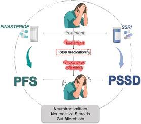 Post-Finasteride Syndrome And Post-Ssri Sexual Dysfunction: Two Clinical Conditions Apparently Distant, But Very Close