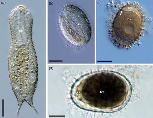 First ultrastructural description of an apomictic opsiblastic egg in freshwater Gastrotricha