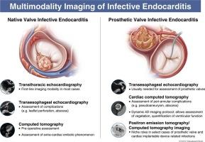 Role of multimodality imaging in infective endocarditis: Contemporary diagnostic and prognostic considerations