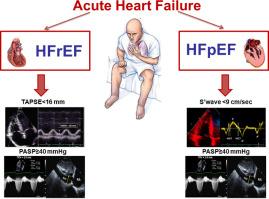 Different right ventricular dysfunction and pulmonary coupling in acute heart failure according to the left ventricular ejection fraction