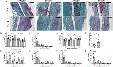 Increased Osteoblast GαS Promotes Ossification by Suppressing Cartilage and Enhancing Callus Mineralization During Fracture Repair in Mice