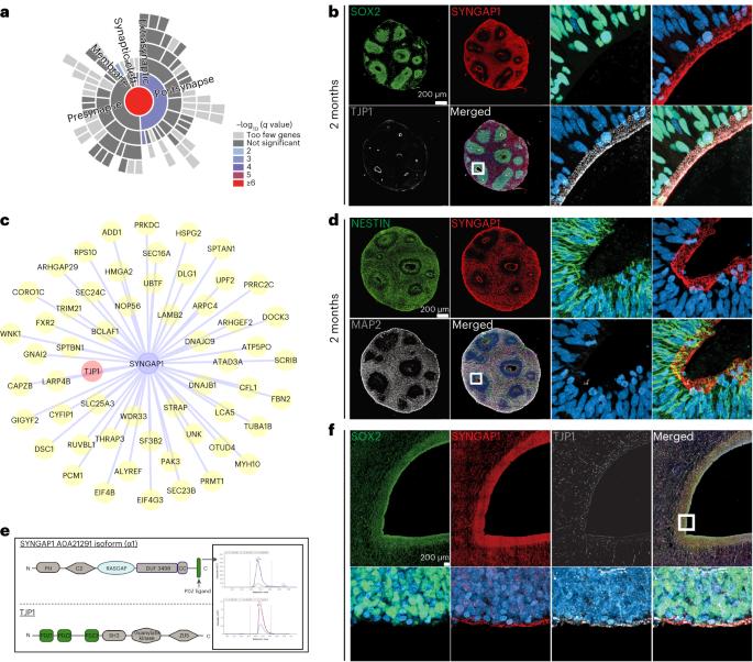 Non-synaptic function of the autism spectrum disorder-associated gene SYNGAP1 in cortical neurogenesis