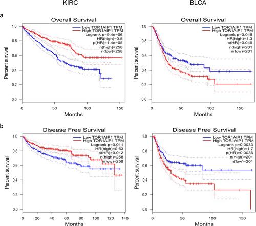 Investigating Torsin-1A-interacting protein 1 as a predictive and immunological biomarker in cancer