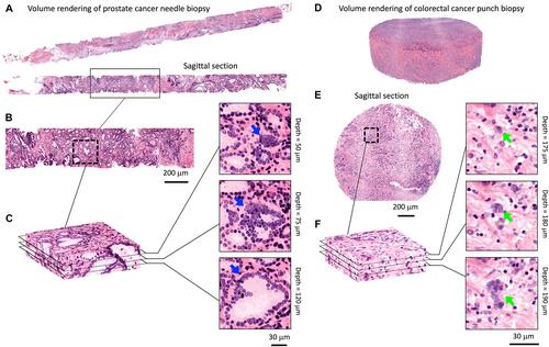 Engineering the future of 3D pathology