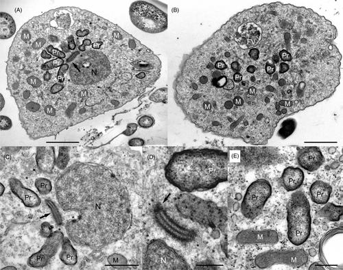 Anaeramoeba pumila sp. nov. and Anaeramoeba sp. OCE22C represent two novel types of symbiosis of Anaeramoebae and prokaryotes