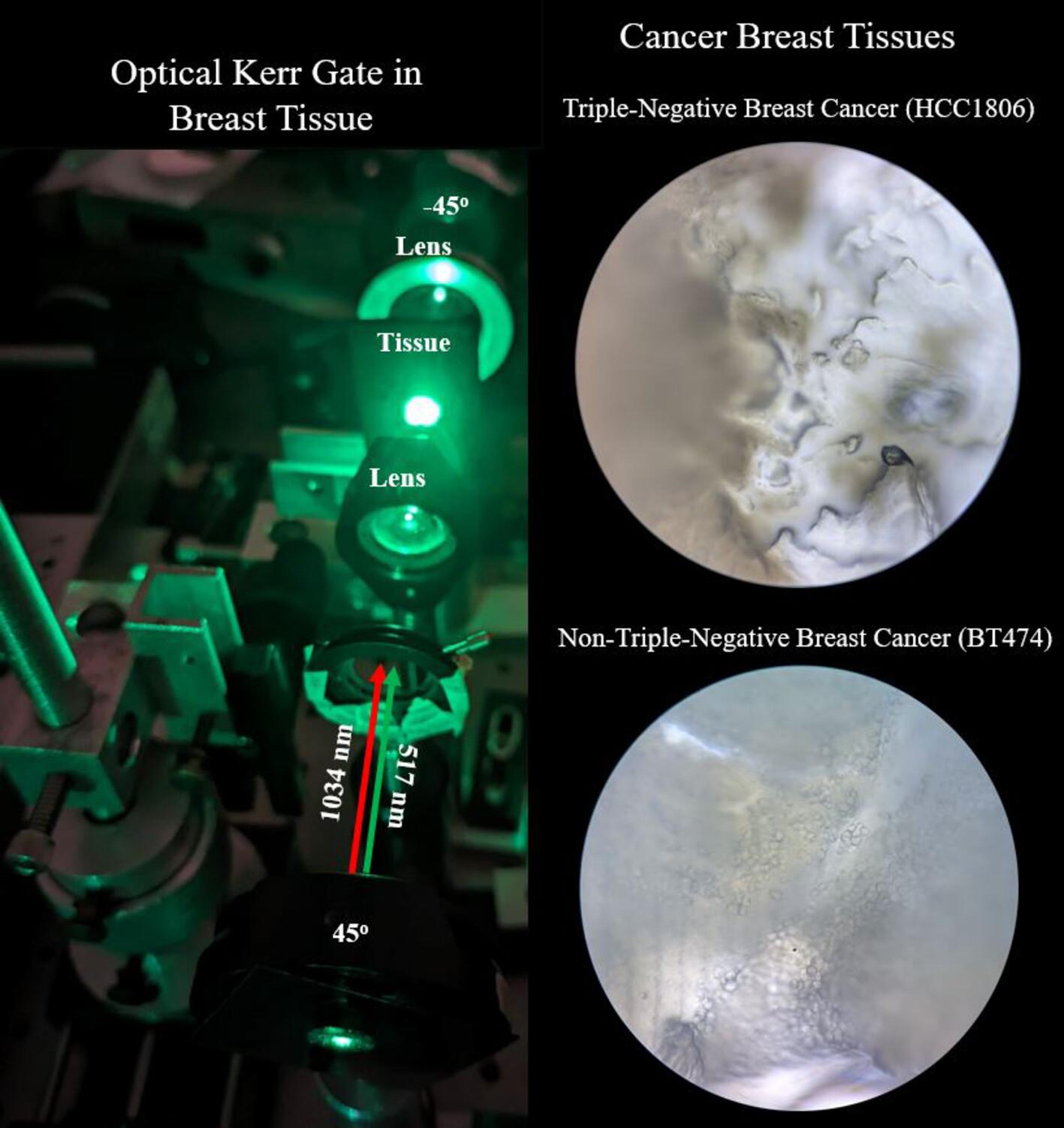 Femtosecond optical Kerr effect in normal and grades of cancerous breast tissues as a new optical biopsy method