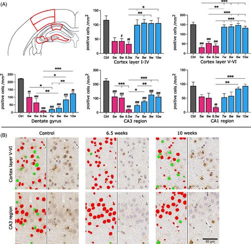 Automated analysis of gray matter damage in aged mice reveals impaired remyelination in the cuprizone model