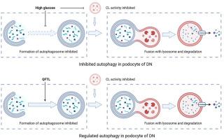 Qufeng tongluo decoction decreased proteinuria in diabetic mice by protecting podocytes via promoting autophagy