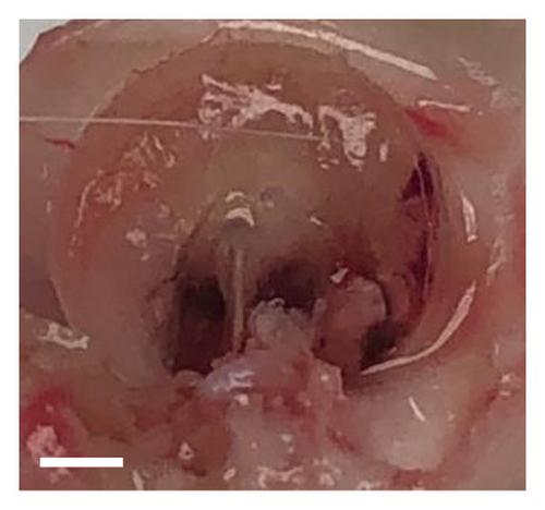 Controlled Release of Mesenchymal Stem Cell-Conditioned Media from a Microsphere/Gel-Based Drug Delivery System for Wound Healing of Tympanic Membrane Perforations