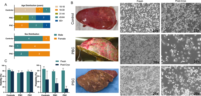 Human Hepatocellular response in Cholestatic Liver Diseases.