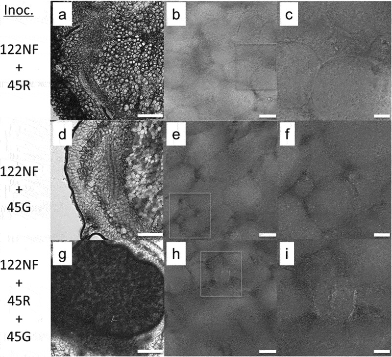 Both incompatible and compatible rhizobia inhabit the intercellular spaces of leguminous root nodules.