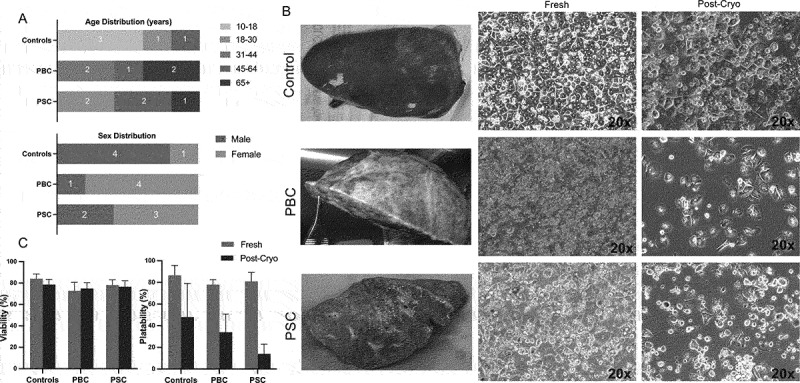 Human Hepatocellular response in Cholestatic Liver Diseases.