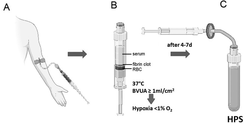 Full-thickness dermal wound regeneration using hypoxia preconditioned blood-derived growth factors: A case series.