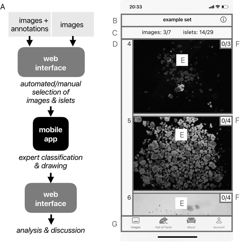 IsletSwipe, a mobile platform for expert opinion exchange on islet graft images.