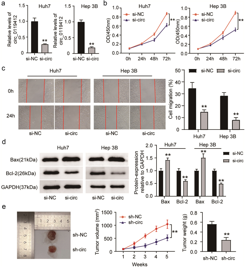 Hsa_circ_0119412 is a tumor promoter in hepatocellular carcinoma by inhibiting miR-526b-5p to upregulate STMN1.